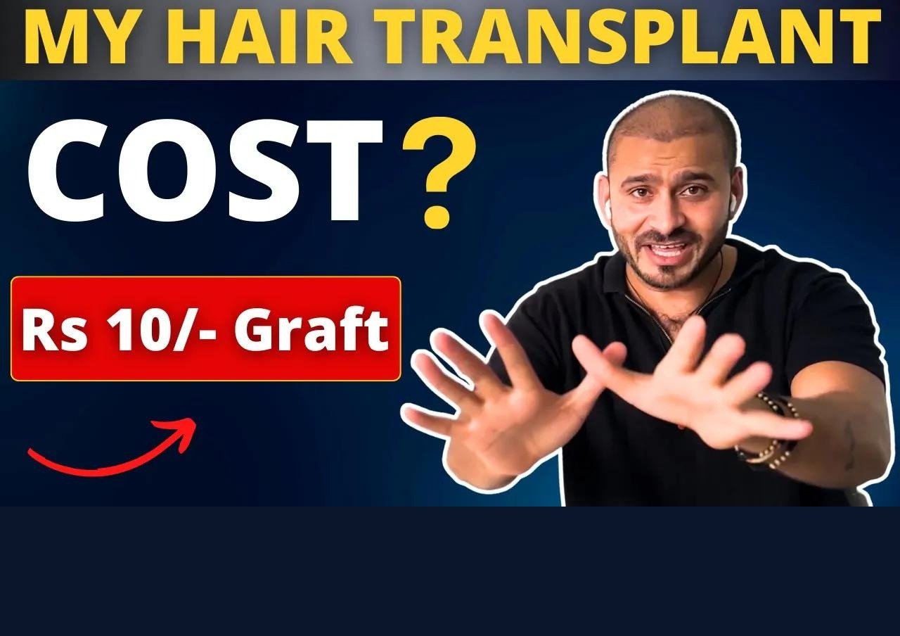 Hair Transplant Cost In India